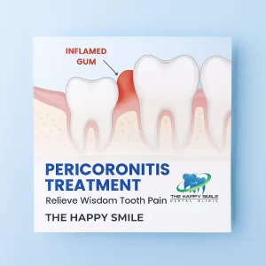 best clinic for Wisdom Tooth Treatment in Chennai